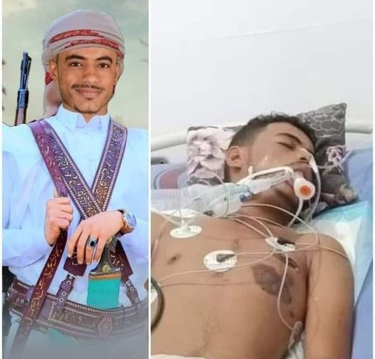 وفاة عروسة ونقل زوجها إلى المستشفى في تعز بظروف غامضة
