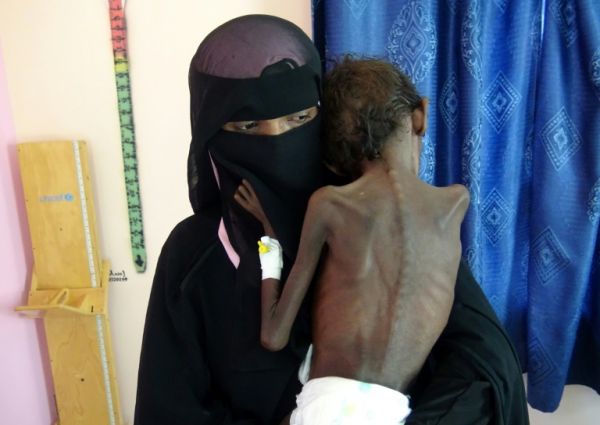 حكومة عدن: ارتفاع نسبة الفقر في اليمن 80% وانكماش الاقتصاد 50%