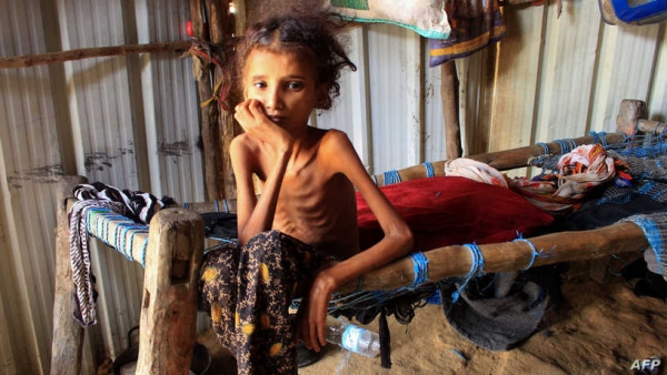 شبكة دولية تحذر: نصف السكان في اليمن مهددون بالمجاعة العام المقبل