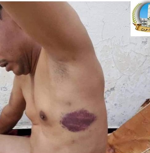 فصائل تابعة للإمارات تعذب مواطنا بوحشية في محافظة شبوة.. تفاصيل