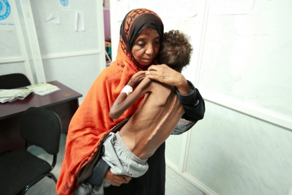 المفوضية الأوروبية تحذّر من ارتفاع سوء التغذية الحاد في اليمن
