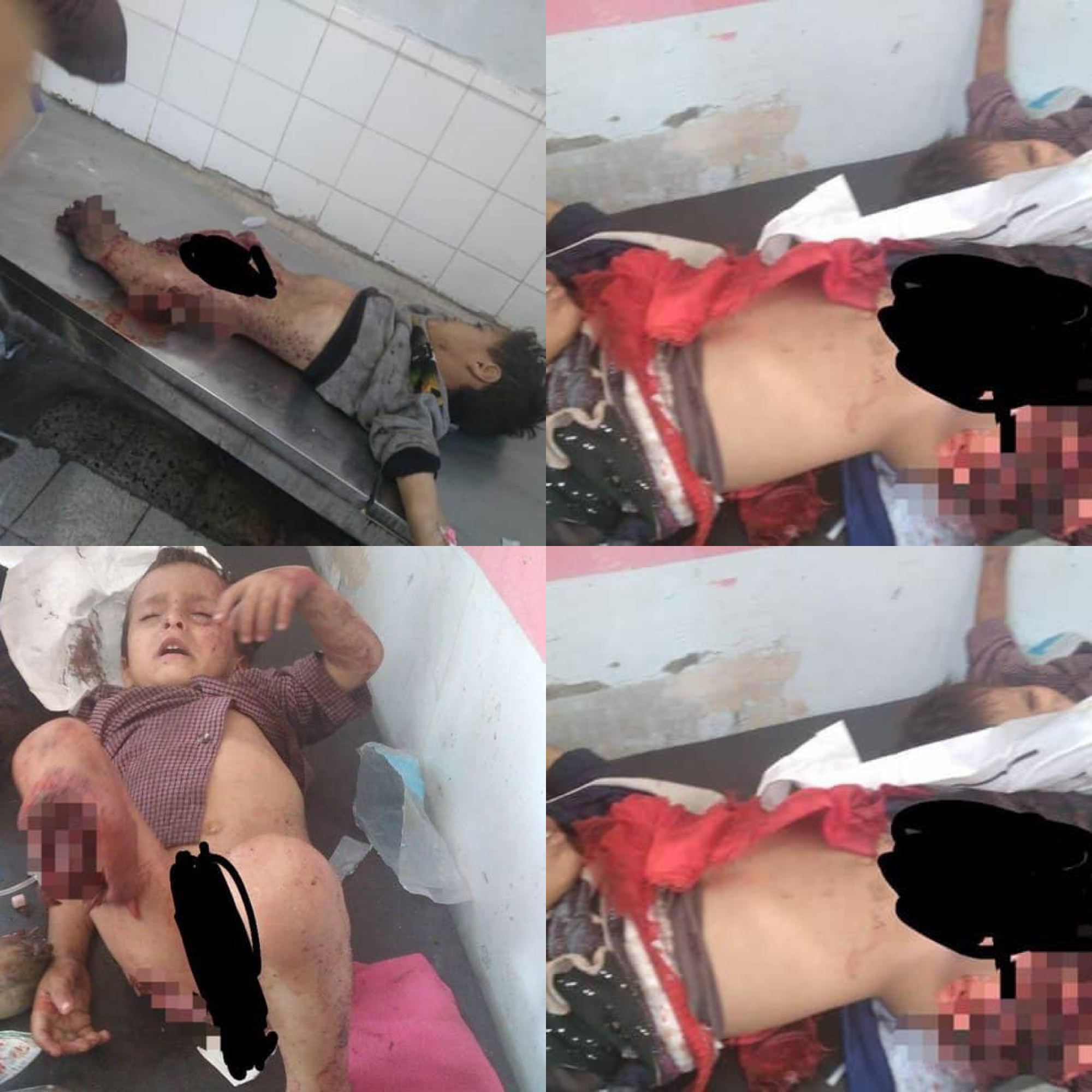 شاهد بالصور  : 29 بين شهيد وجريح في قصف الحوثي على الجوبة مارب بينهم اطفال 