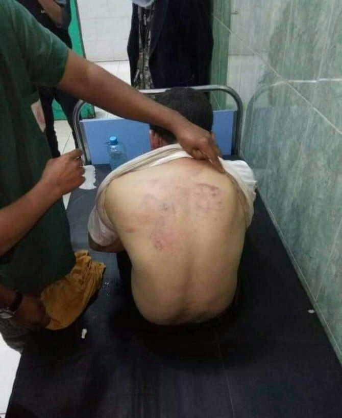 شاهد بالصورة : ميليشيا مسلحة تابعة لأمن عدن تختطف مواطن وتقوم بتعذيبه بسجن سري