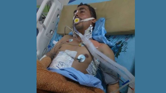 إب.. الرصاص الراجع يدخل مواطنا غرفة العناية المركزة