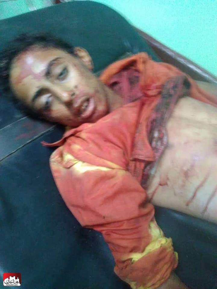 شاهد صورته:الإعلامي عادل اليافعي ينشر صورة مواطن من تعز قتلته ميليشيا الحزام الأمني في لحج