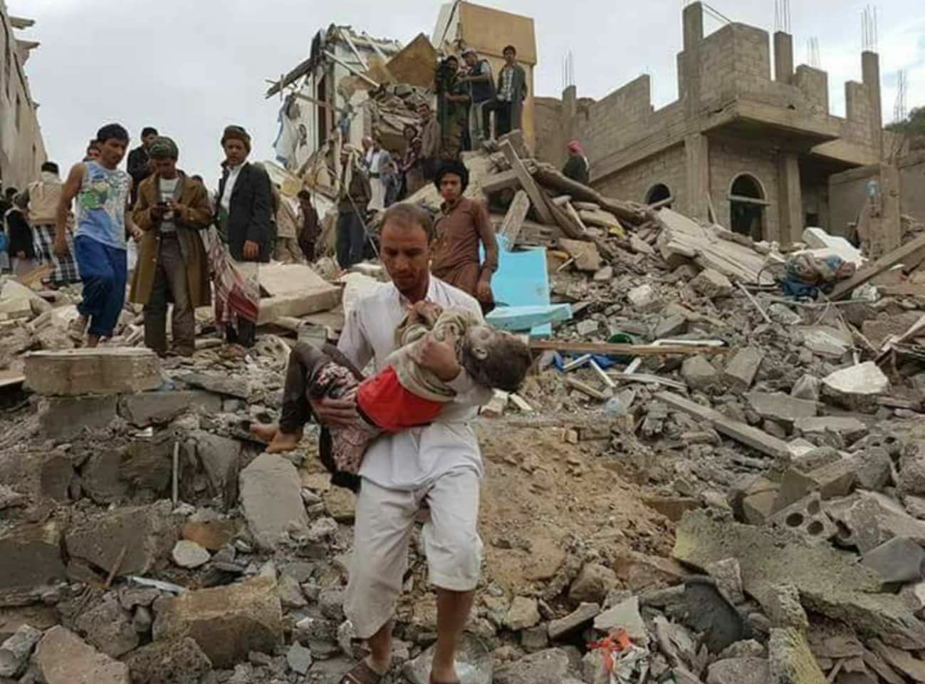 إصابة مدنيين بينهم نساء وأطفال برصاص مليشيات الحوثي في الحديدة 