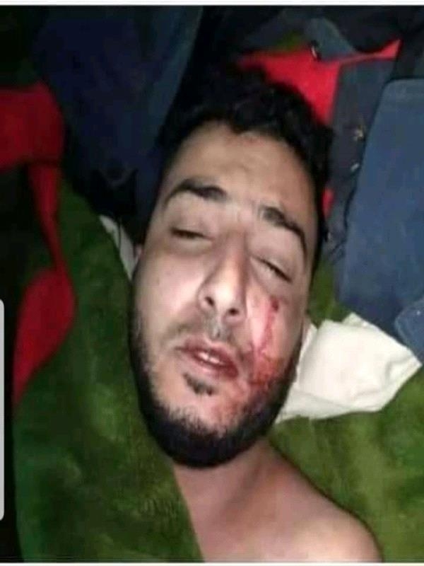طالما الوعي به و بتداعياته المدمرة ما زال دون مستوى إدراك خطورته .. : الصحفي سامي الكاف يطالب بتحويل قضية السنباني إلى قضية (رأي عام)