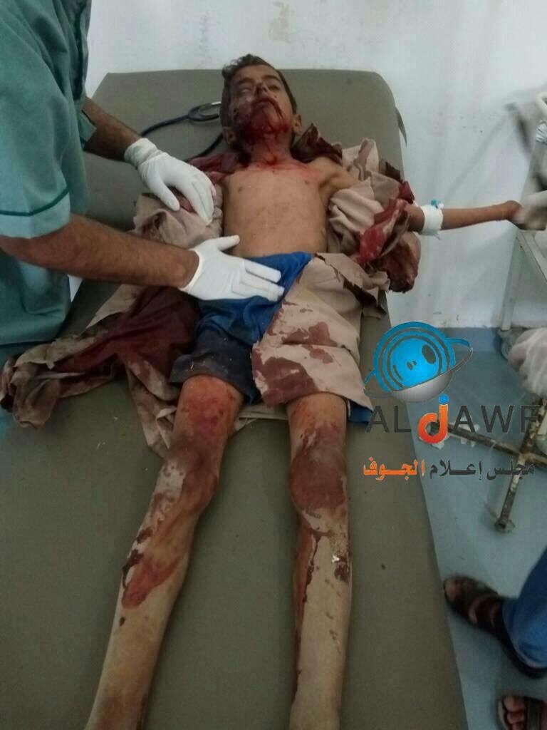 الجوف؛استشهاد وجرح 32 طفلاً بقصف حوثي على الغيل في الجوف منذ أكتوبر 2016*