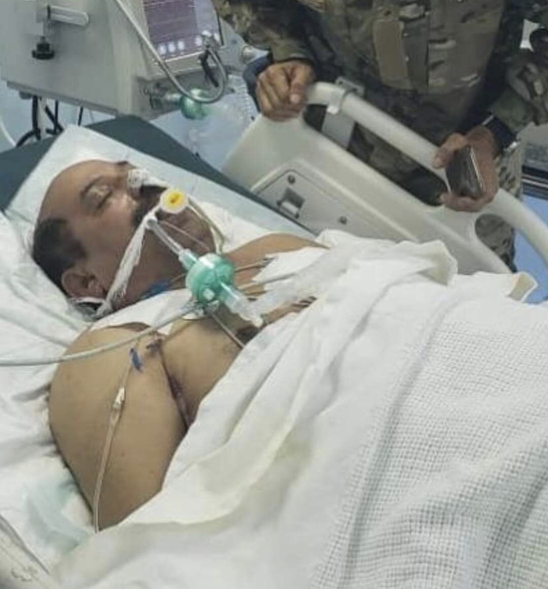عاجل : وفاة اللواء طماح في عدن متأثراً بإصابته 