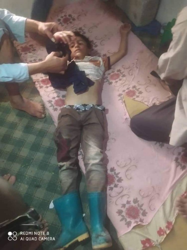 إصابة طفل جراء قصف حوثي في الصلو جنوبي تعز