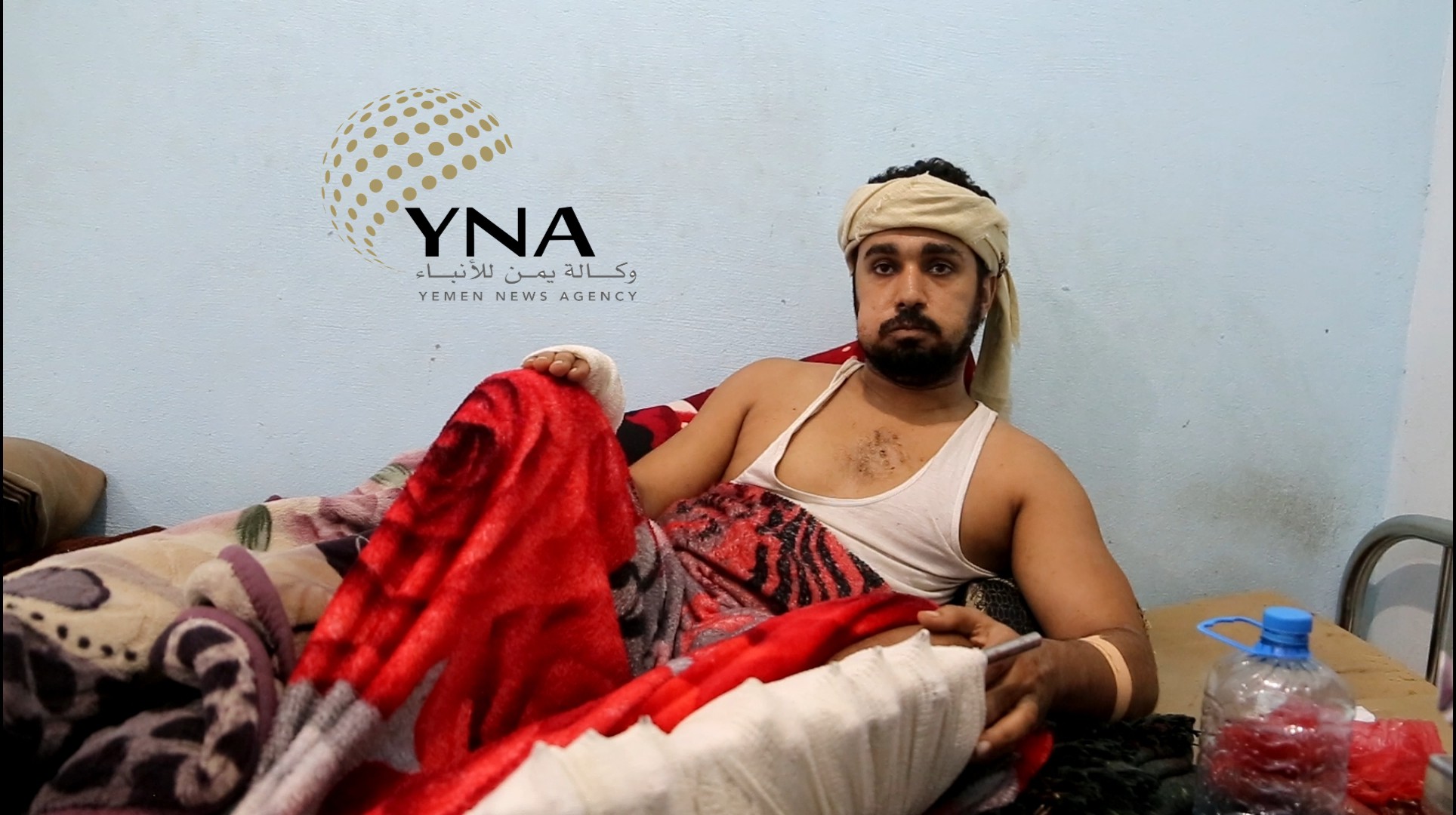 تعز... أحد أفراد أسرة "الحرق" الجرحى يروي تفاصيل الحادثة ويرفض أي "تسييس" للقضية