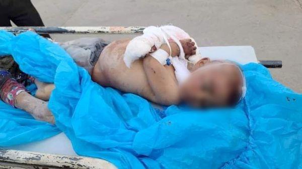 منظمة سياج تحذر من الجرائم والانتهاكات بحق أطفال اليمن