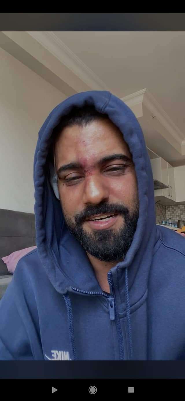 مجهولون يعتدون على أحد مذيعي قناة "بلقيس" في اسطنبول بتركيا