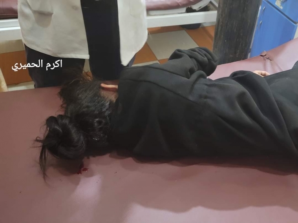 إصابة طفلة برصاص قناص حوثي في بئر باشا غربي تعز