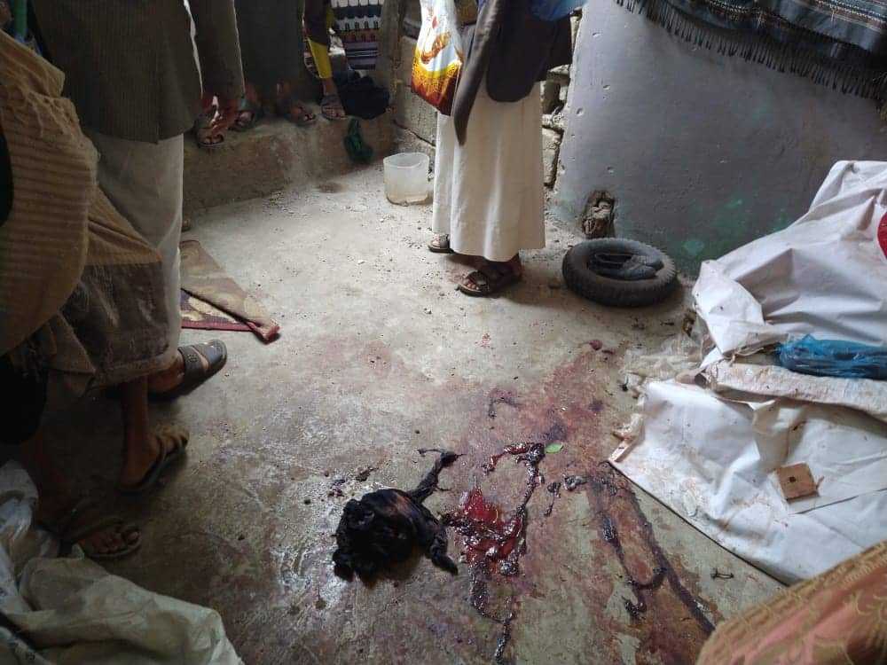 مسلح حوثي يقتل زوجته وجنينها بقنبلة يدوية في ريف محافظة حجة
