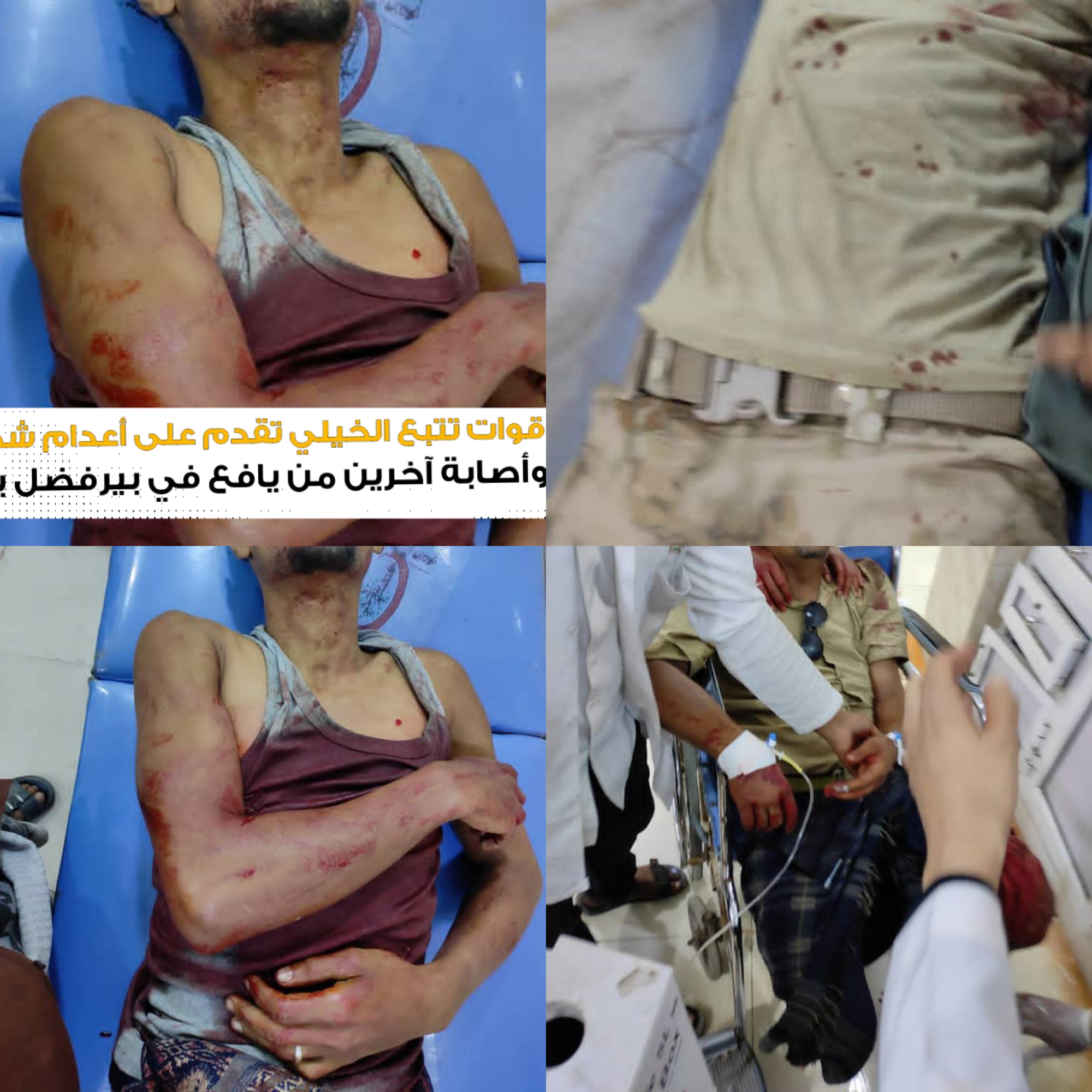 قوات تتبع الخيلي تقدم على أعدام شخصين وأصابة آخرين من يافع في بيرفضل بعدن*
