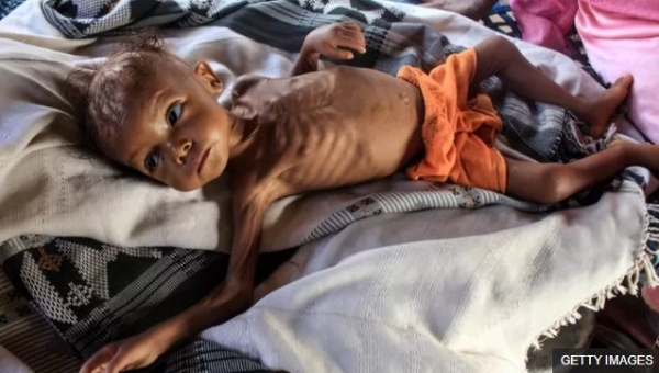 الصليب الأحمر يقول إن 19 مليون شخص باليمن فقدوا الأمن الغذائي بسبب الحرب