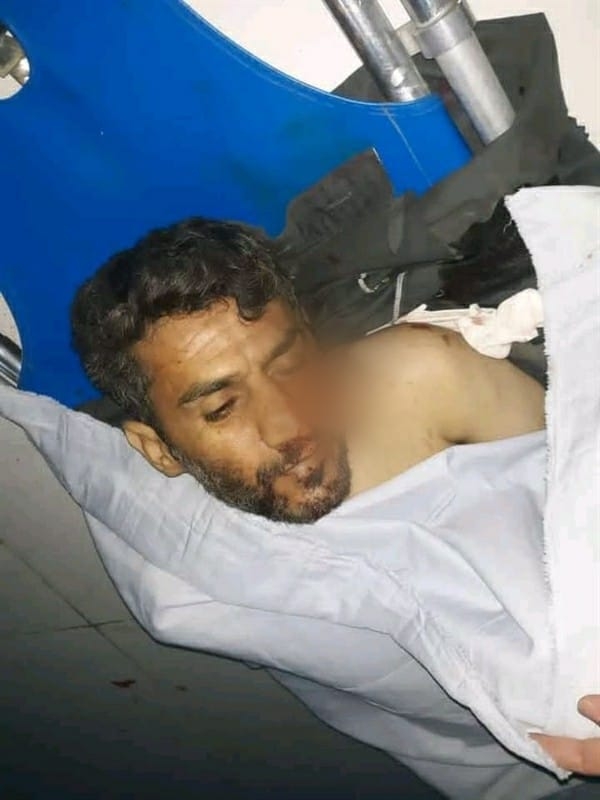 مقتل معلم برصاص مسلحي جماعة الحوثي محافظة في عمران